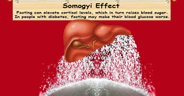 Diabetes Somogyi Effect