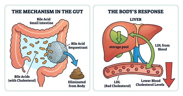 how bile acid sequestrants lower cholesterol. The left panel shows the drug acting inside the small intestine to bind bile acids and eliminate them from the body. The right panel illustrates the liver pulling bad LDL cholesterol directly out of a blood vessel to replace its depleted internal storage pool.