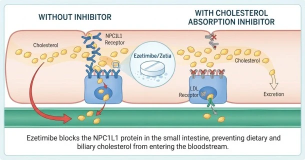 Infographic diagram showing how Ezetimibe (Zetia) blocks dietary and biliary cholesterol absorption in the small intestine to lower blood LDL levels.