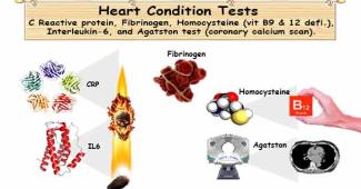 Heart Condition Tests