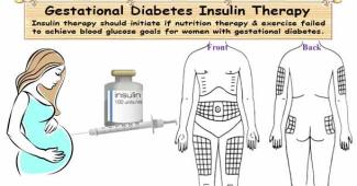 Gestational Diabetes Insulin