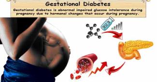 Gestational Diabetes
