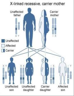 Colorblindness Causes
