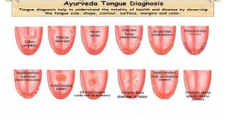 Ayurvedic Tongue Diagnosis