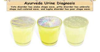 Ayurvedic Urine Diagnosis