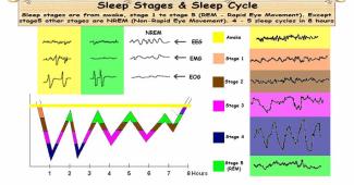 Sleep Stages & Sleep Cycle